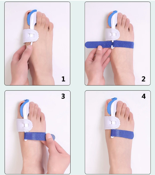Paire d'attelles de correction d’orteils hallus valgus.