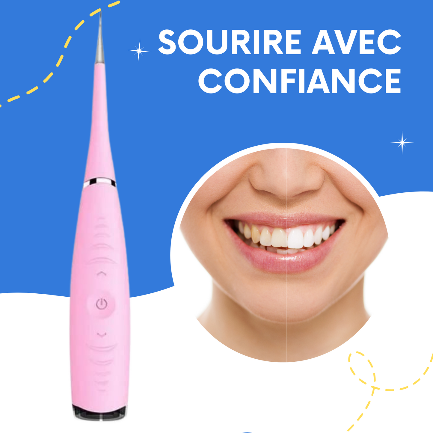 Nettoyeur de dents électrique à ultrasons