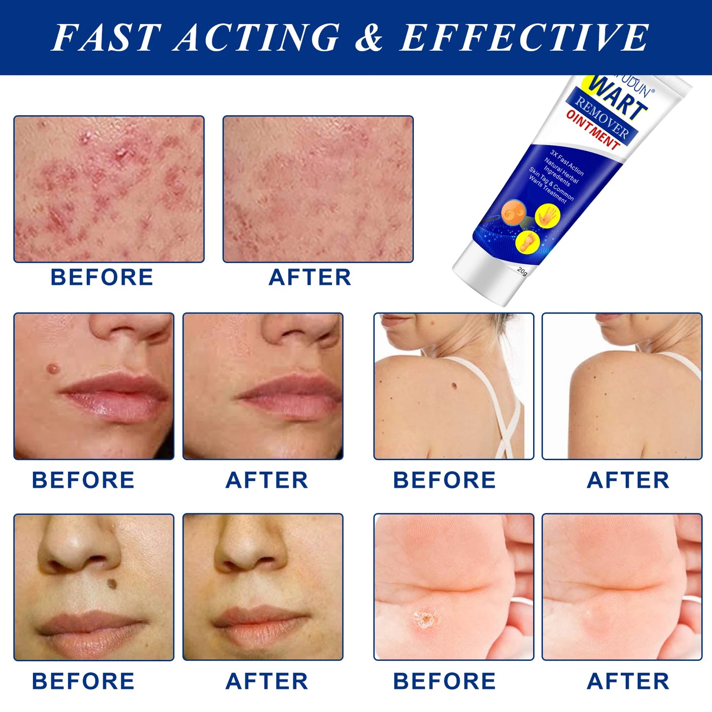 Crème anti-verrue révolutionnaire.