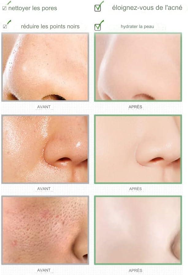 Masque à l'argile purifiante au thé vert, anti-acné