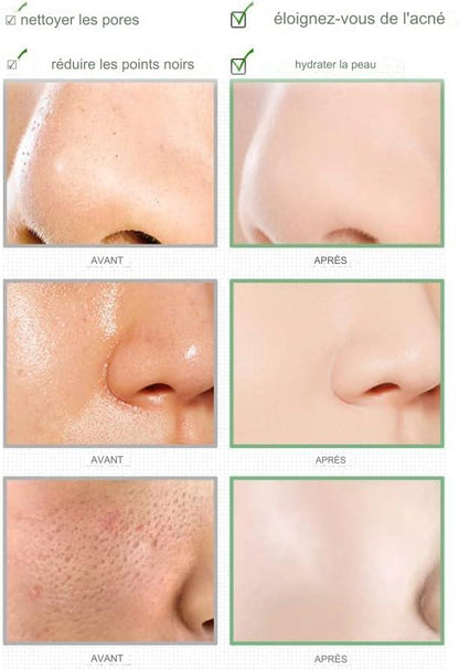 Masque à l'argile purifiante au thé vert, anti-acné