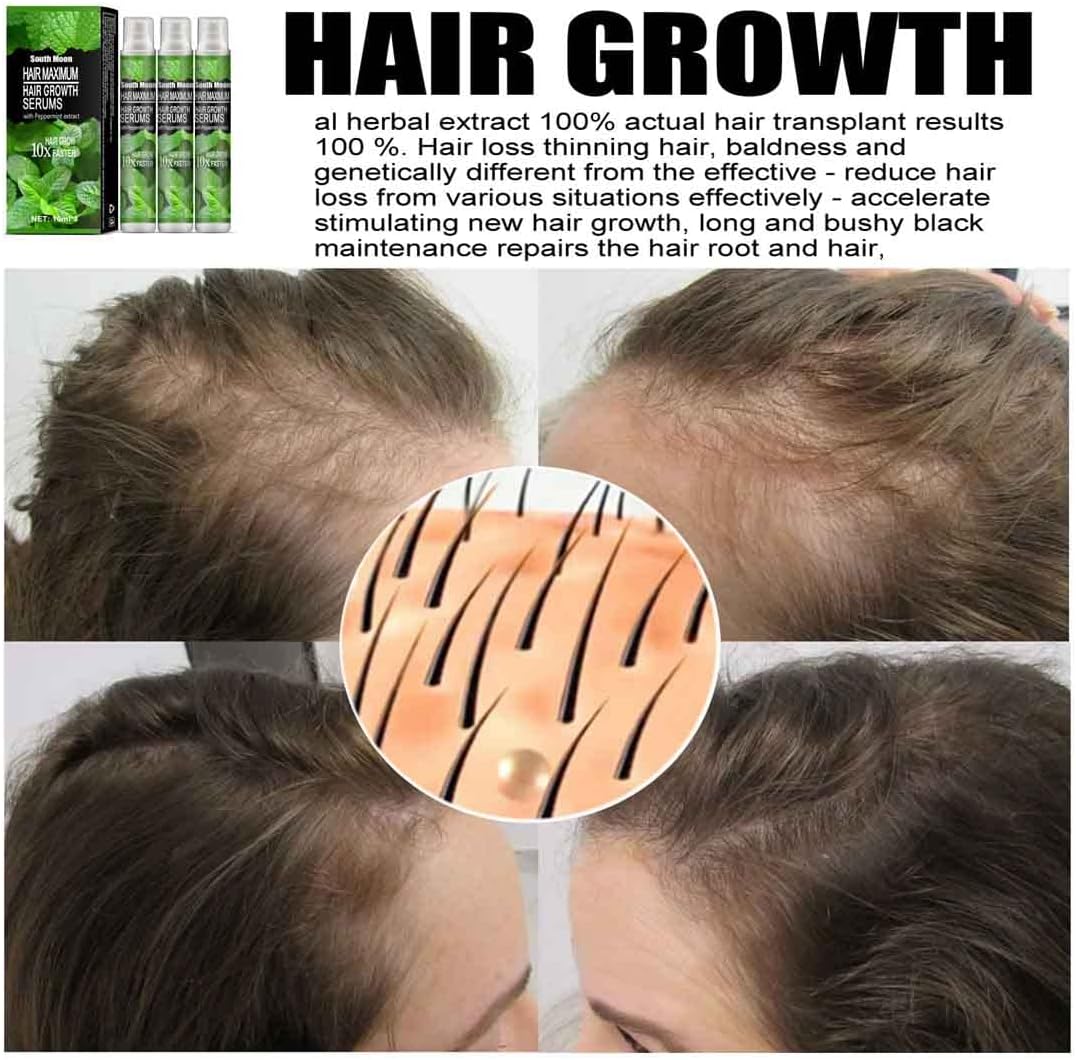 Spray pour la renaissance des cheveux.