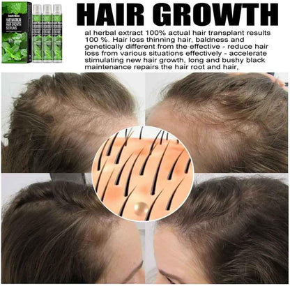 Spray pour la renaissance des cheveux.