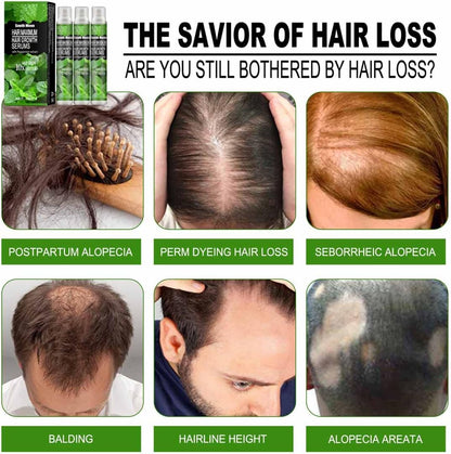 Spray pour la renaissance des cheveux.