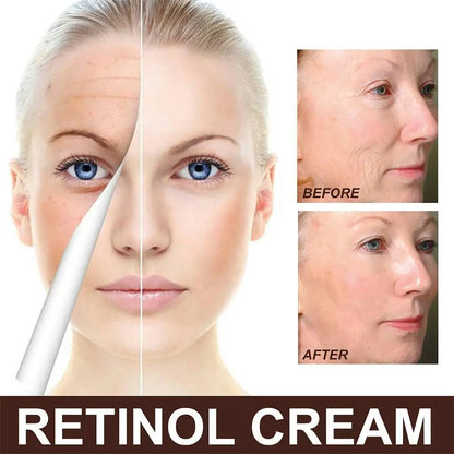 Crème pour le visage anti-rides au rétinol.