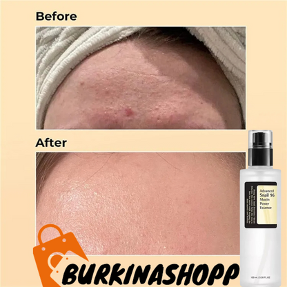 Sérum Advanced Snail Mucin Power Essence 96% Pour Le Visage.