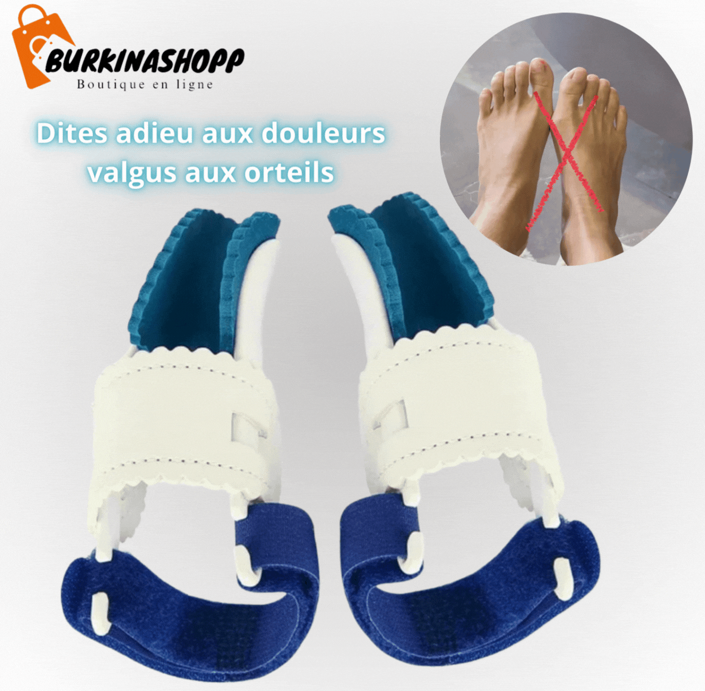 Paire d'attelles de correction d’orteils hallus valgus.