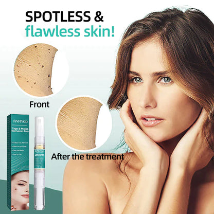 Stylo dissolvant anti-verrues efficace.