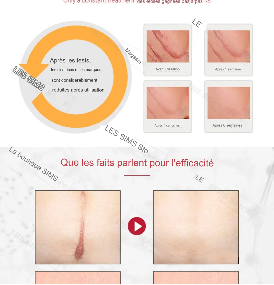 Gel pour l'élimination des cicatrices et des marques d'acné TCM.