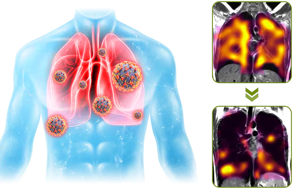 Googeer - spray nettoyant pulmonaire révolutionnaire.