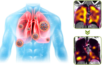 Googeer - spray nettoyant pulmonaire révolutionnaire.